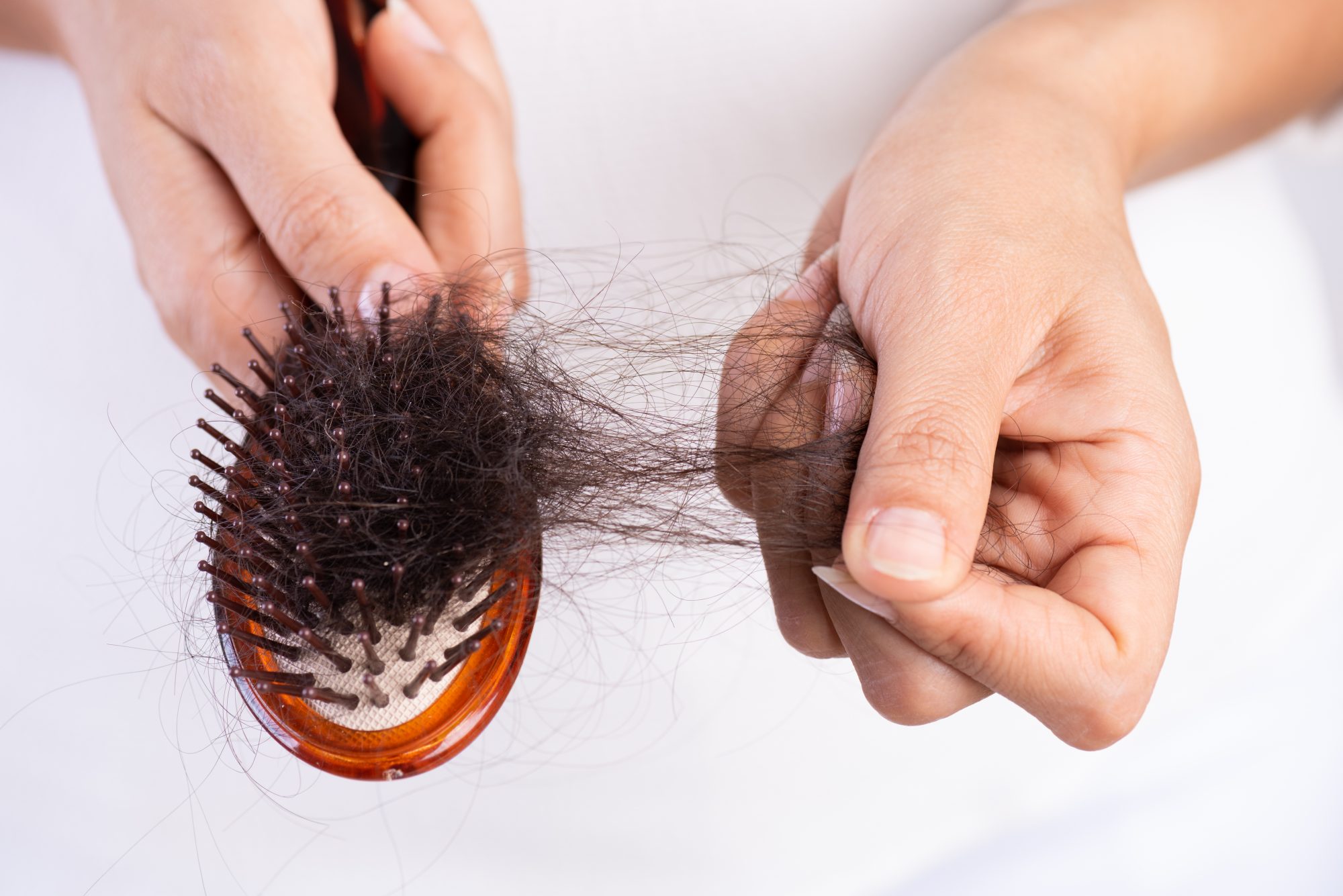 Các triệu chứng stress ở nữ giới phổ biến - rụng tóc